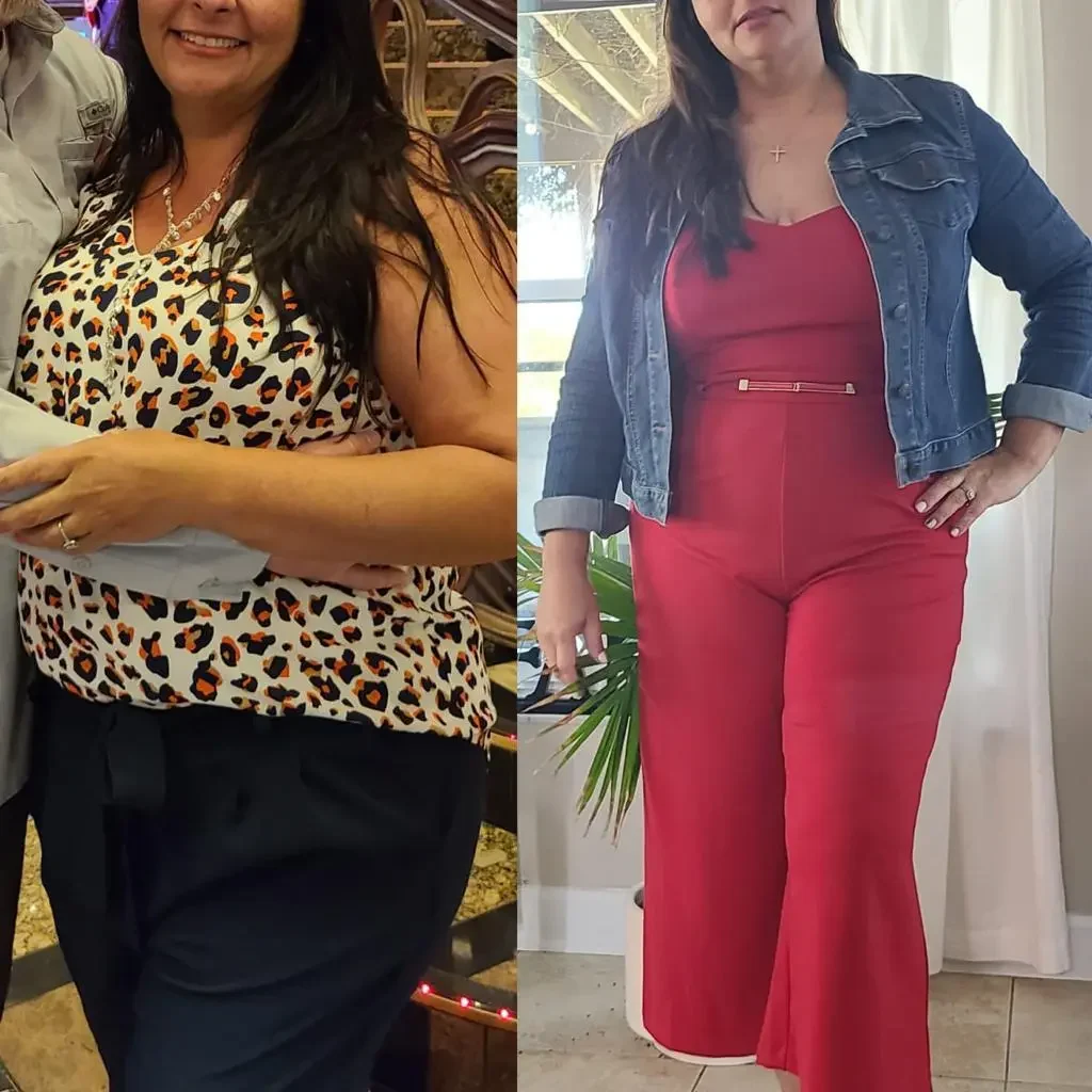 Before-after-weight-losS