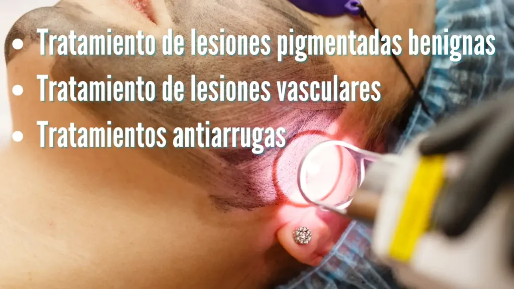 ELIMINAR ARRUGAS CON LASER