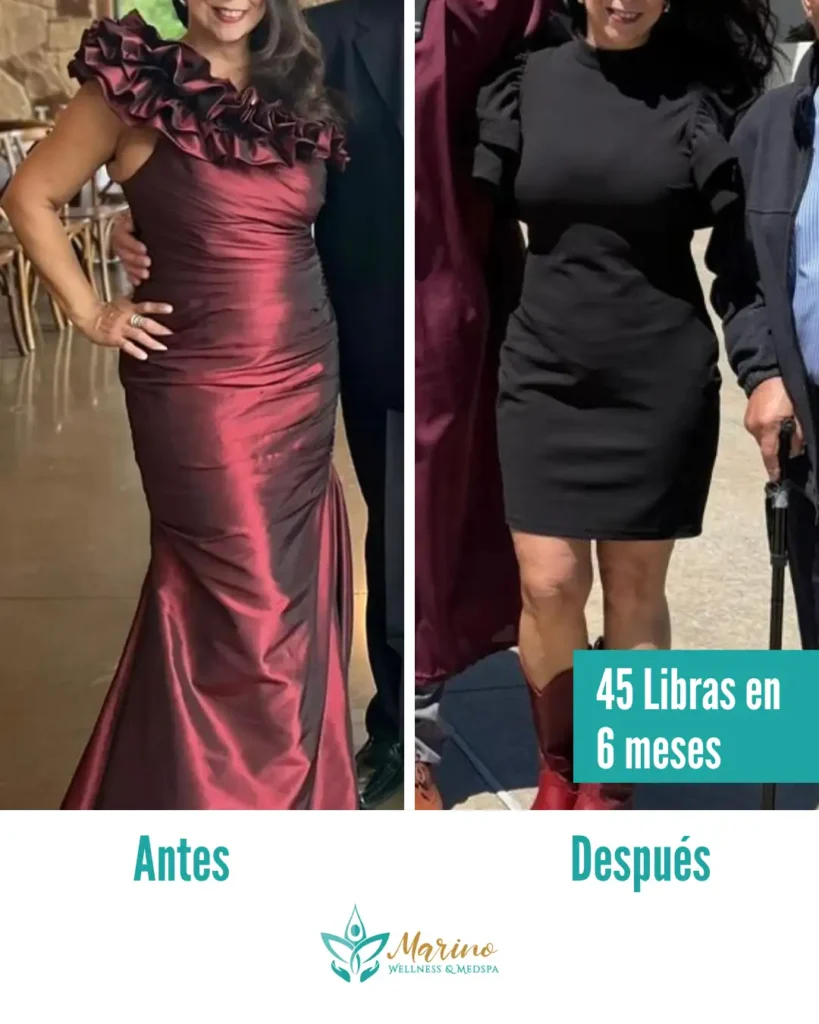 weight loss program